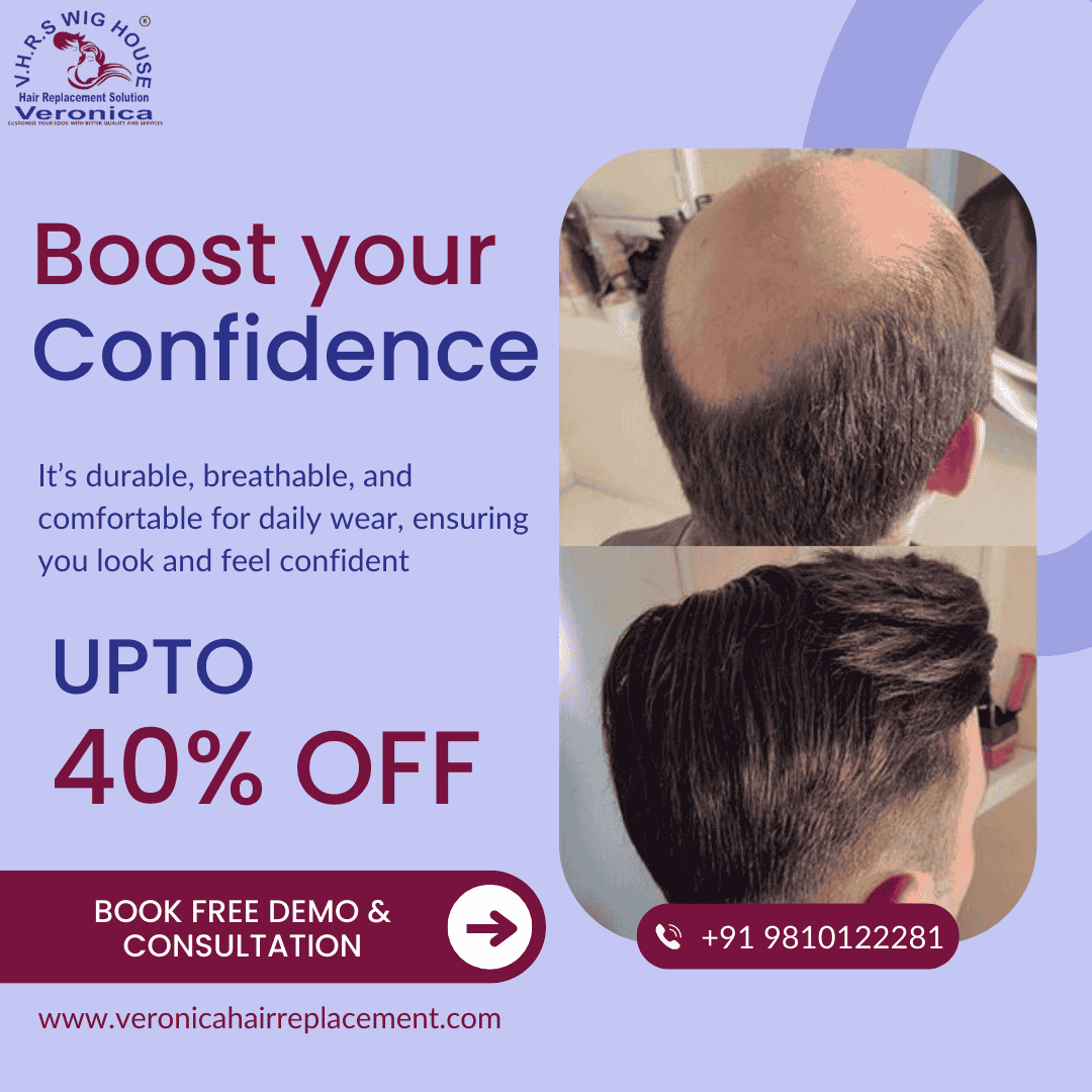 Non-Surgical Hair Replacement & Baldness Solutions in Delhi